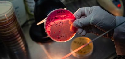 Petri dish